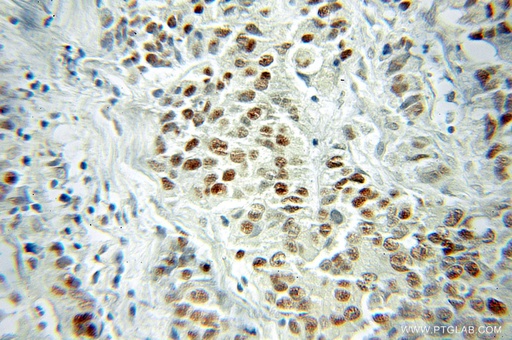 [10124-2-AP-150UL] VGLL1 Polyclonal antibody