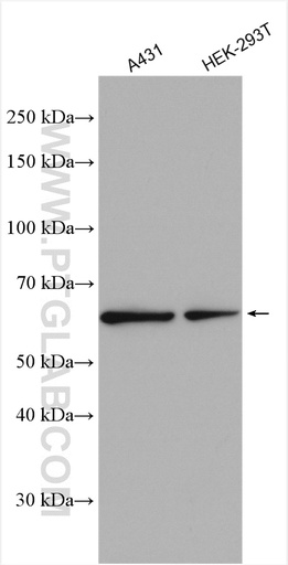 [10126-2-AP-20UL] CPNE1 Polyclonal antibody