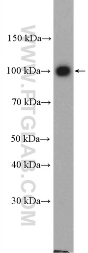 [10130-1-AP-20UL] Adaptin Polyclonal antibody