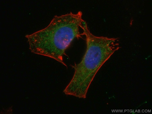 [10150-2-AP-20UL] GNAS Polyclonal antibody