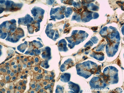 [10154-2-AP-20UL] Annexin VII Polyclonal antibody