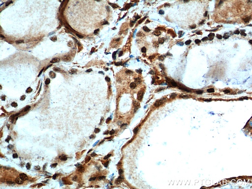 [10159-2-AP-20UL] MYCN Polyclonal antibody