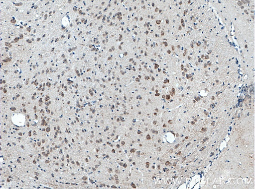 [10162-1-AP-20UL] C17orf81 Polyclonal antibody