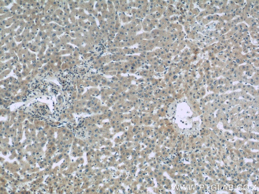 [10170-1-AP-150UL] Complement factor B Polyclonal antibody