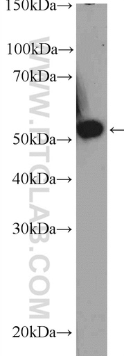 [10177-2-AP-150UL] TBRG4 Polyclonal antibody