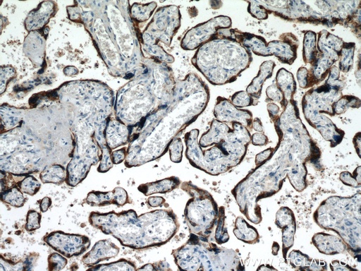 [10178-1-AP-20UL] Placental lactogen Polyclonal antibody