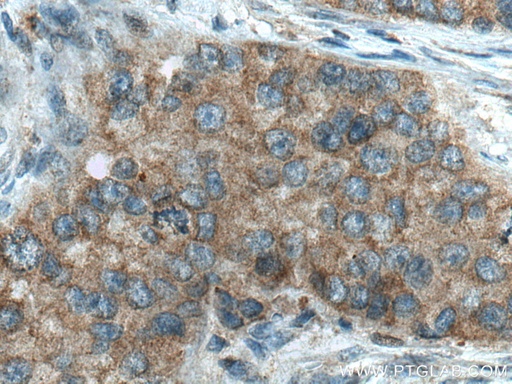 [10182-1-AP-20UL] DCTN5 Polyclonal antibody