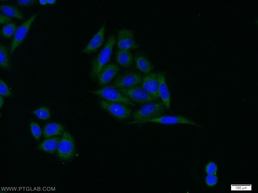 [10189-2-AP-20UL] IGFBP3 Polyclonal antibody