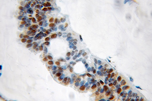 [10190-2-AP-20UL] GNL2 Polyclonal antibody