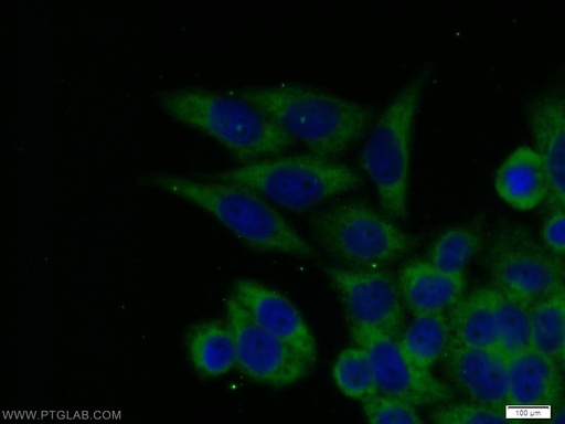 [10192-1-AP-20UL] ECD Polyclonal antibody