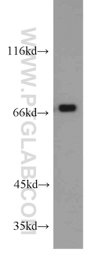 [10196-1-AP-150UL] RBM14 Polyclonal antibody