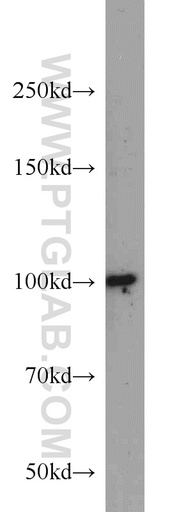 [10199-2-AP-20UL] DDX23 Polyclonal antibody