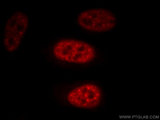 [10208-1-AP-20UL] EFTUD2 Polyclonal antibody