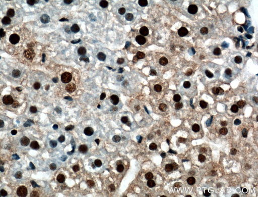 [10210-2-AP-20UL] RUVBL1 Polyclonal antibody