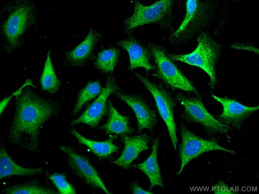 [10211-1-AP-20UL] HSPBP1 Polyclonal antibody
