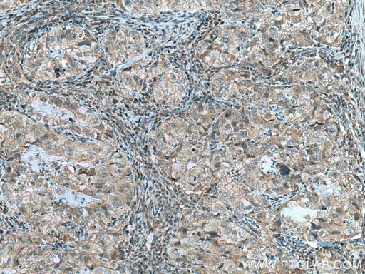 [10213-2-AP-20UL] RABEPK/p40 Polyclonal antibody