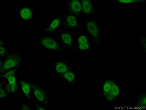 [10214-1-IG-20UL] TSC22D1 Polyclonal antibody