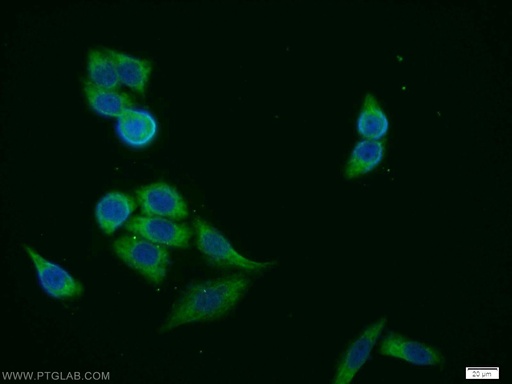 [10215-1-AP-20UL] FANCG Polyclonal antibody