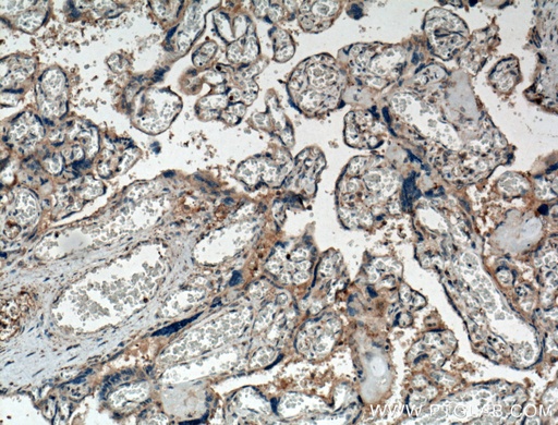 [10216-1-AP-20UL] Chemerin Polyclonal antibody
