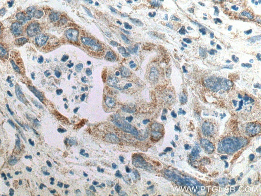 [10217-1-AP-20UL] SAPK4 Polyclonal antibody
