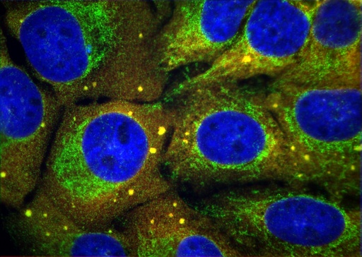 [10219-1-AP-20UL] EIF3D Polyclonal antibody