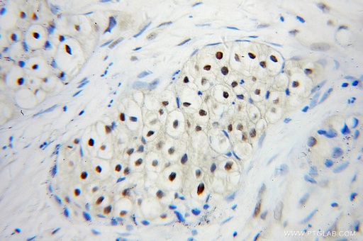 [10224-1-AP-150UL] UBC9 Polyclonal antibody
