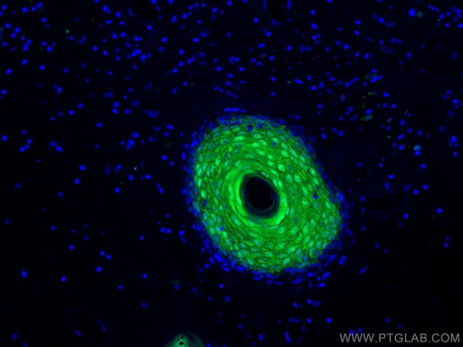 [10225-1-AP-20UL] CRABP2 Polyclonal antibody