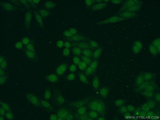 [10229-1-AP-150UL] SAE1 Polyclonal antibody