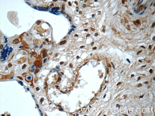 [10231-1-AP-150UL] SMAD4 Polyclonal antibody