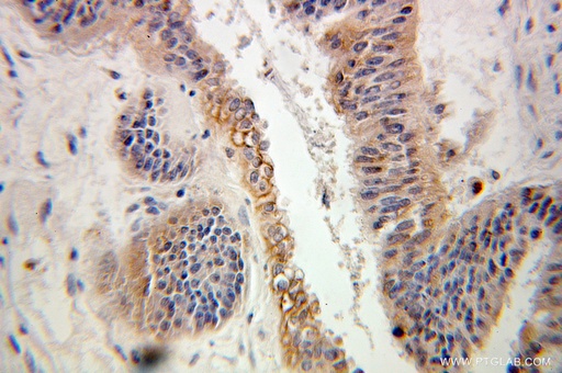 [10232-1-AP-150UL] ARL2 Polyclonal antibody