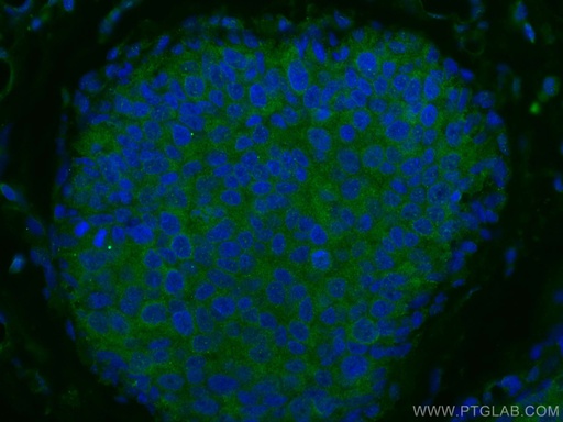 [10233-1-AP-20UL] NDE1 Polyclonal antibody