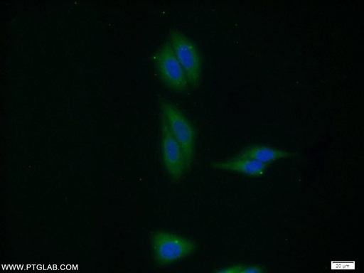 [10236-1-AP-150UL] VPS35 Polyclonal antibody