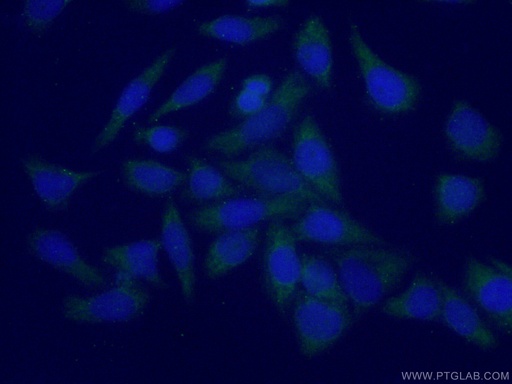 [10238-1-AP-150UL] PLEKHA1 Polyclonal antibody