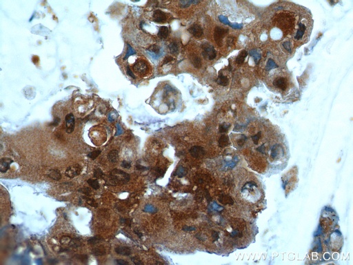 [10243-1-AP-20UL] UBC13 Polyclonal antibody