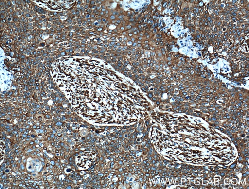 [11229-1-AP-20UL] MAP4 Polyclonal antibody