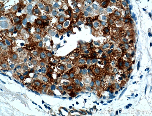 [11230-1-AP-150UL] Casein Kinase 1 Epsilon Polyclonal antibody