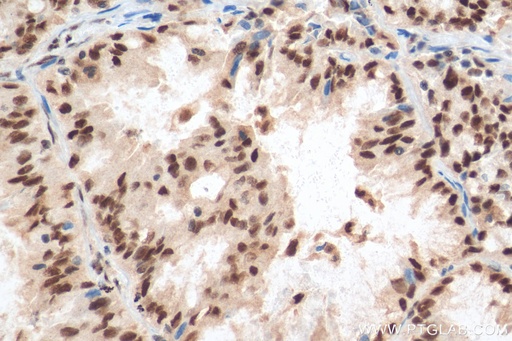 [11231-1-AP-20UL] SETDB1 Polyclonal antibody