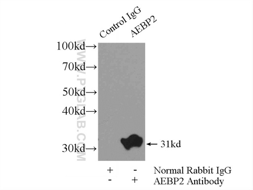 [11232-2-AP-20UL] AEBP2 Polyclonal antibody
