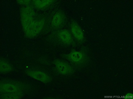 [11235-2-AP-20UL] CREB3L1,OASIS Polyclonal antibody
