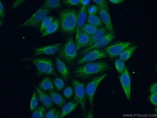 [11244-1-AP-20UL] AASDHPPT Polyclonal antibody
