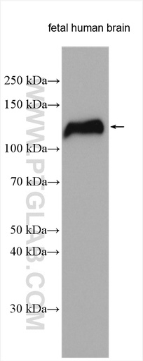 [11268-1-AP-20UL] NELL2 Polyclonal antibody
