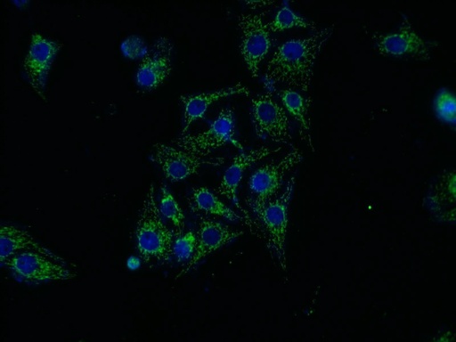 [11274-1-AP-150UL] ASAH1 Polyclonal antibody