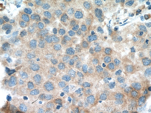 [11280-1-AP-150UL] EIF4A2 Polyclonal antibody