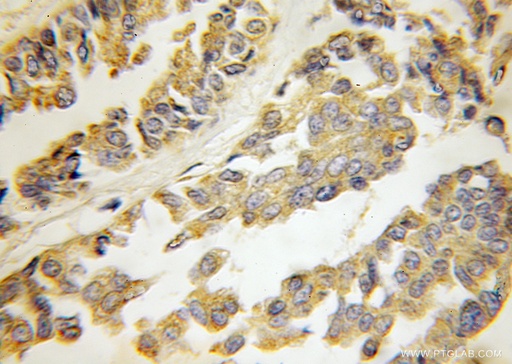 [11301-1-AP-150UL] HARS2 Polyclonal antibody