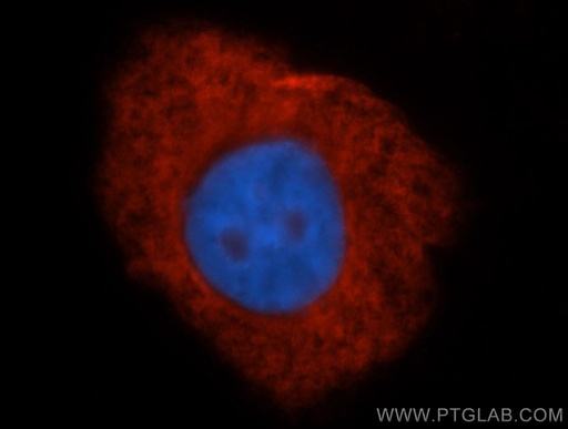 [11302-1-AP-150UL] ribosomal protein L4 Polyclonal antibody
