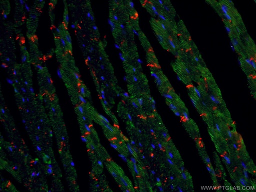 [11313-2-AP-20UL] Alpha Actinin Polyclonal antibody