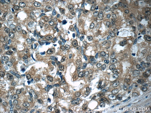 [11316-1-AP-20UL] Aminoacylase 1 Polyclonal antibody