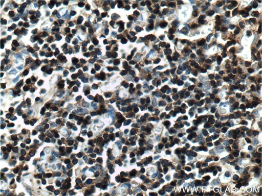 [11326-1-AP-20UL] LAT Polyclonal antibody