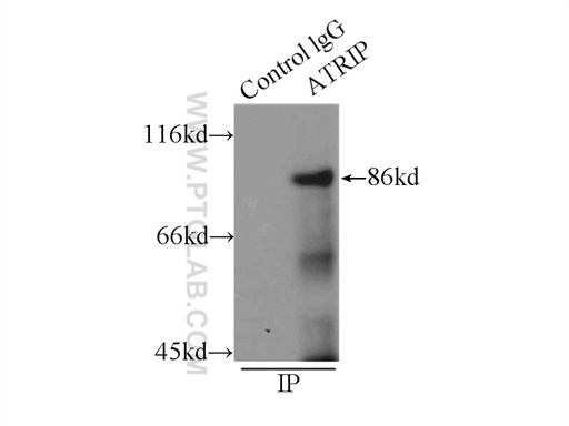 [11327-1-AP-150UL] ATRIP Polyclonal antibody