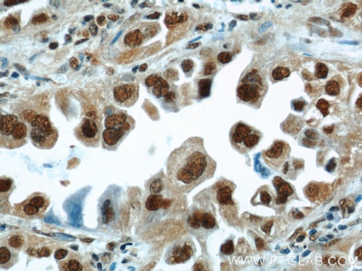[11344-1-AP-150UL] HDGF Polyclonal antibody